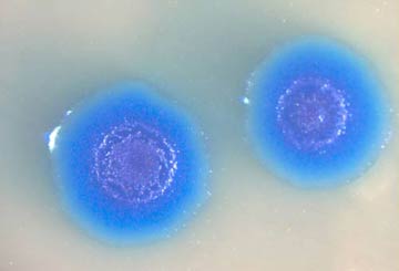 071114-mycoplasma_mycoides.jpg