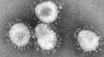 virus-130612.jpg